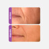 Mini Retinol